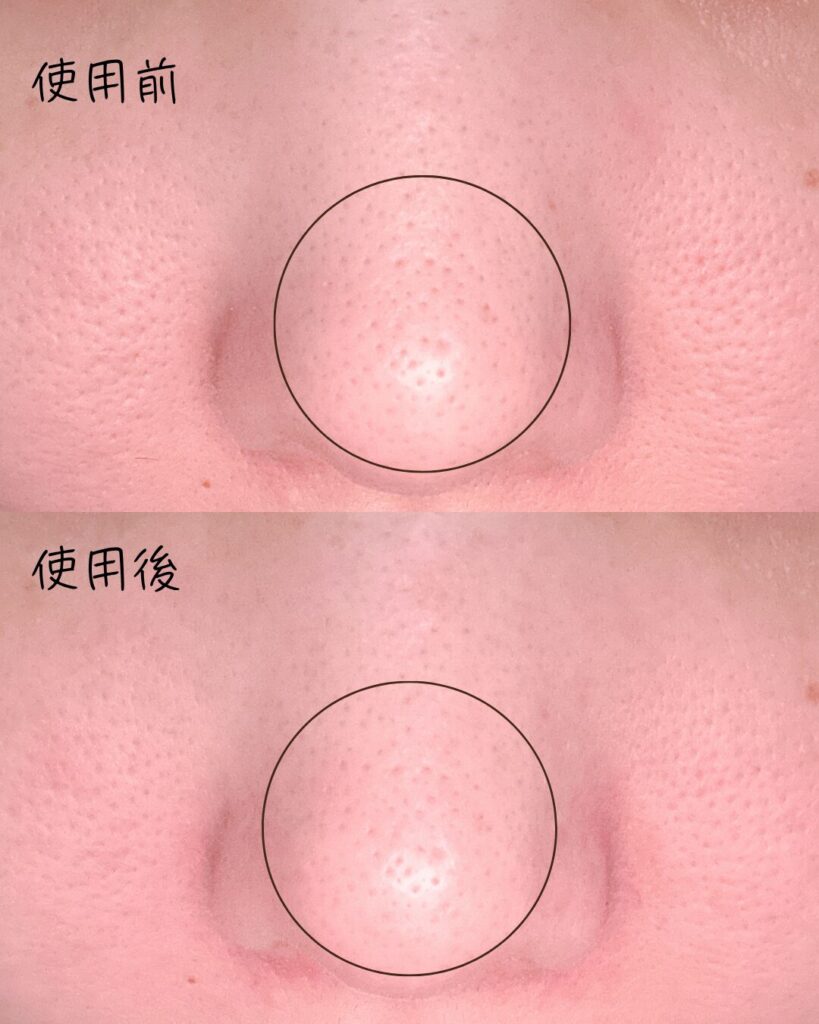 毛穴の汚れはしっかり落ちた?