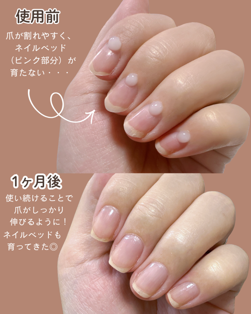 検証】クリアストロングショットアルファの口コミは本当？1ヶ月使ってみた