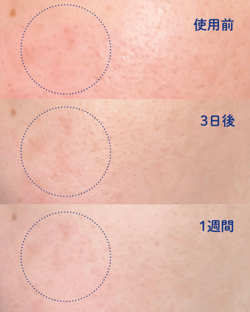 エクストリームクリームを一週間使ってみた