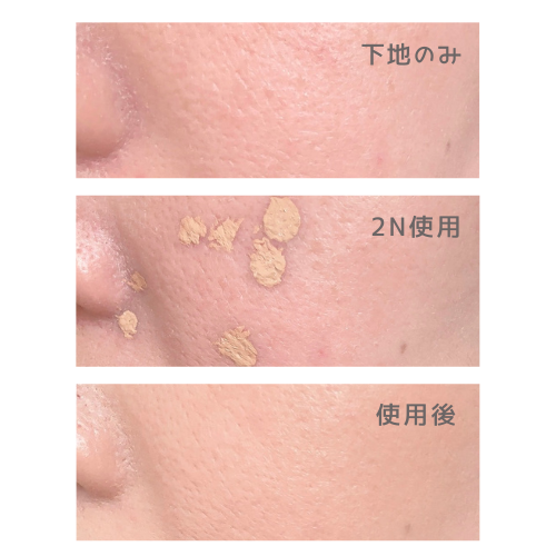 【写真付き】ダーマシンコンシーラーを使ってみた