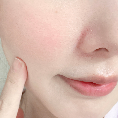 毛穴の目立たないキメの整った肌へ