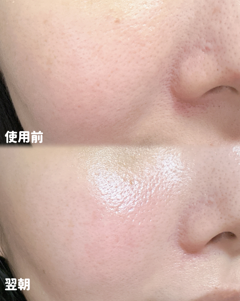 ヒアロディープパッチを使った翌朝