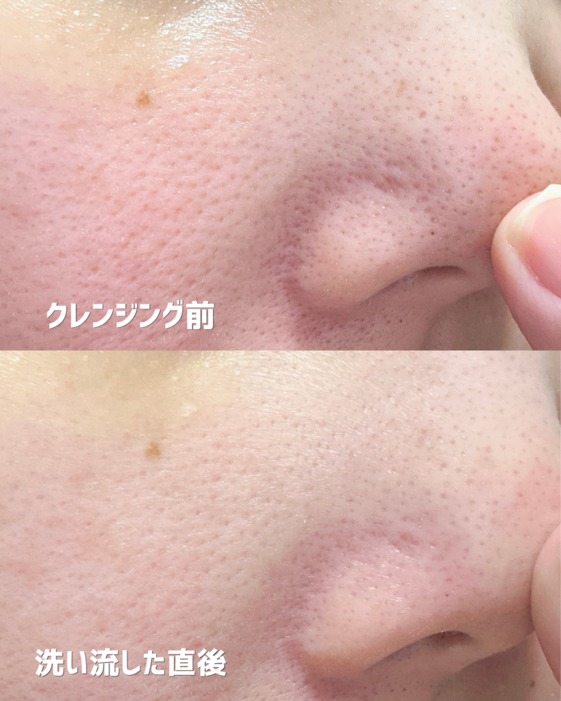 チャプトナイン ポアクリアセラム洗い流した直後の写真はこちら
